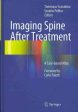 Imaging Spine After Treatment Fashion